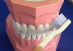 歯と歯ぐきの間